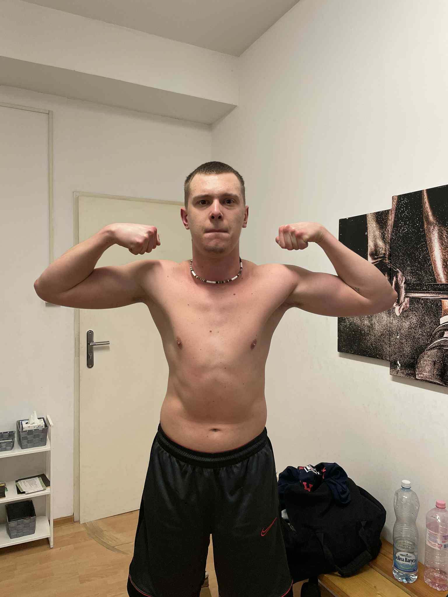 Igor, zdjęcie przed
