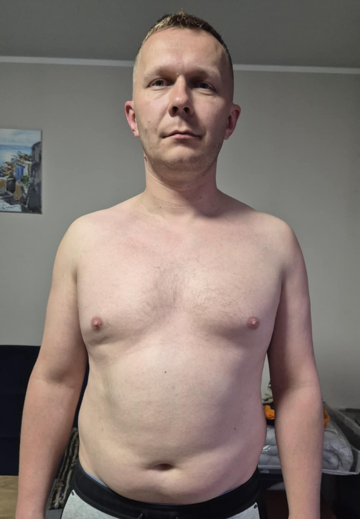 Tomasz, zdjęcie przed